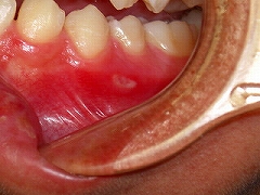 �������Ŏ��s���ɂ�