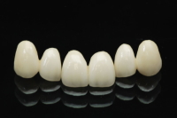 �I�[���Z���~�b�N�N���E��