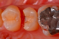 �l�ߕ��E���Ԃ������Ƃꂽ