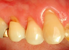 �߂��ߕq�ɂ���Ď������݂�