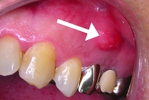 ���̍��������^��Œɂ�