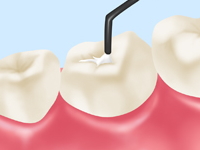 �V�[�����g