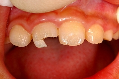 �Ԃ�����A�]��Ŏ����������E�܂ꂽ