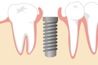 �C���v�����g��p