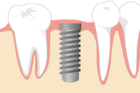 ���ƌ�������܂ł̎�������