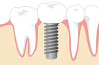 �㕔�\���̍쐻�E����